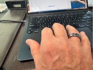 Actual photo of my hand and the Oura ring!