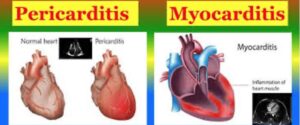 COVID Vaccine Controversy Part Three: Alleged mRNA Risks, Heart Conditions, and Government-Media Cover-Up Claims