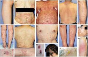 Three Studies That Challenge COVID Vaccine Safety Claims